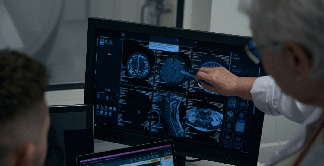 Common catastrophic injuries and impacts - Traumatic Brain Injuries